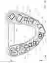 Fig. 02 - Method of making a dental arch model