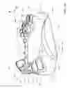 Fig. 07 - Method of making a dental arch model