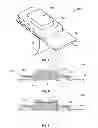 Fig. 03 - PATCH FOR NON-INVASIVE PAIN RELIEF