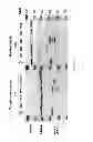 Fig. 07 - Expression of isoform 202 of ERCC1 for predicting response to cancer chemotherapy