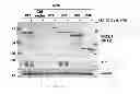 Fig. 08 - Expression of isoform 202 of ERCC1 for predicting response to cancer chemotherapy