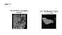 Fig. 15 - Biomarkers of ionizing radiation