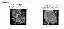 Fig. 17 - Biomarkers of ionizing radiation