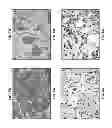 Fig. 09 - COMPOSITIONS AND METHODS FOR CULTURING CELLS FROM NORMAL HUMAN TUBO-OVARIAN EPITHELIUM AND HUMAN TUBO-OVARIAN TUMORS