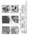 Fig. 10 - COMPOSITIONS AND METHODS FOR CULTURING CELLS FROM NORMAL HUMAN TUBO-OVARIAN EPITHELIUM AND HUMAN TUBO-OVARIAN TUMORS