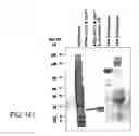 Fig. 441 - Factor IX:  Remodeling and Glycoconjugation of Factor IX