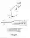 Fig. 85 - Factor IX:  Remodeling and Glycoconjugation of Factor IX