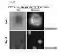 Fig. 08 - METHOD FOR PREPARING INDUCED PLURIPOTENT STEM CELLS USING MICROVESICLES DERIVED FROM EMBRYONIC STEM CELLS
