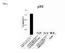Fig. 04 - Method for preparing corneal endothelial cell