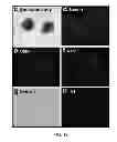 Fig. 12 - Constructs for making induced pluripotent stem cells