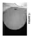 Fig. 04 - OPEN WATER SWIM TRAINING DEVICE