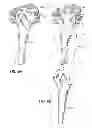 Fig. 07 - Convertible flower doll