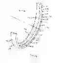 Fig. 07 - Sensor bearing assembly for a pulley