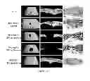 Fig. 08 - Polymer hydrogels for in vivo applications and methods for using and preparing same