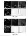 Fig. 07 - Methods of reducing levels of tau
