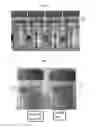 Fig. 07 - Methods and systems for bio-oil recovery and separation aids therefor