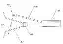 Fig. 01 - Body part repositioning apparatus and method