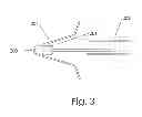 Fig. 04 - Body part repositioning apparatus and method