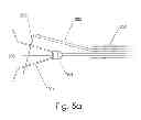 Fig. 07 - Body part repositioning apparatus and method