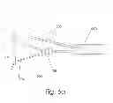 Fig. 09 - Body part repositioning apparatus and method