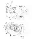 Fig. 04 - Retrieval basket apparatus