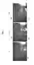 Fig. 06 - Endoscope apparatus and image pickup control method thereof