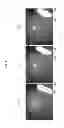 Fig. 07 - Endoscope apparatus and image pickup control method thereof