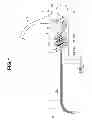 Fig. 02 - INSERTION APPARATUS