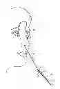 Fig. 01 - ELECTRONIC INTUBATION