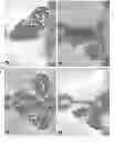 Fig. 07 - Method for deep brain stimulation targeting based on brain connectivity