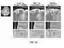Fig. 06 - Method for 3D motion tracking in an MRI scanner using inductively coupled microcoils