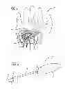 Fig. 02 - METHOD AND APPARATUS FOR THREAD TRANSECTION OF A BODY TISSUE