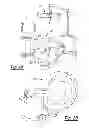 Fig. 04 - Method and apparatus for optimizing a computer assisted surgical procedure