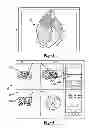 Fig. 05 - Method and apparatus for optimizing a computer assisted surgical procedure