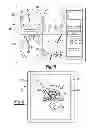 Fig. 06 - Method and apparatus for optimizing a computer assisted surgical procedure