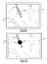 Fig. 08 - Method and apparatus for optimizing a computer assisted surgical procedure