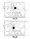 Fig. 09 - Method and apparatus for optimizing a computer assisted surgical procedure