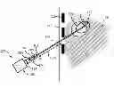 Fig. 01 - Displacement feedback device and method for sensing or therapy delivery probes