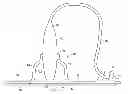 Fig. 01 - MEDICAL DEVICE SUPPORT APPARATUS