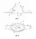 Fig. 02 - MEDICAL DEVICE SUPPORT APPARATUS