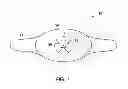 Fig. 03 - MEDICAL DEVICE SUPPORT APPARATUS