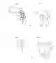 Fig. 02 - Optical speculum