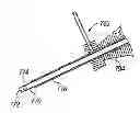 Fig. 01 - Biological unit removal tools with movable retention member