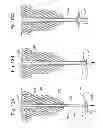 Fig. 14 - Biological unit removal tools with movable retention member