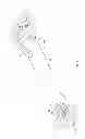 Fig. 02 - Vacuum assisted lancing system with elective vacuum release and method for blood extraction with minimal pain