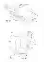 Fig. 02 - Back Treatment Apparatus