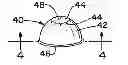 Fig. 01 - Methods for wound protection and therapy