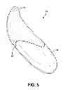 Fig. 04 - Vibrator