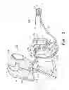 Fig. 02 - HIGH FREQUENCY CHEST WALL OSCILLATION SYSTEM