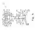 Fig. 07 - HIGH FREQUENCY CHEST WALL OSCILLATION SYSTEM